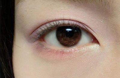 深圳哪些医院在治疗眼睛肿胀方面排名前10？