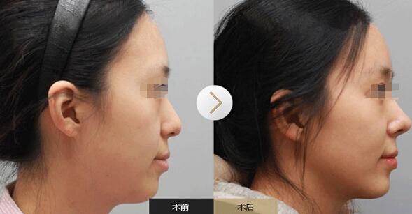 榆林医院整形美容医院（榆林医院整形美容医院地址） 榆林医院整形美容医院（榆林医院整形美容医院地点
）《榆林整形美容医院哪家好》 整形美容