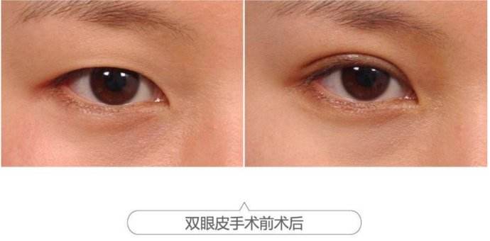 南京紧肤光纤溶脂：2023比较推崇的医疗美容医院排行榜！
