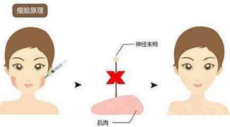杭州激光治疗疤痕疙瘩一次一般需要消费多少钱(2023杭州激光治疗疤痕疙瘩参考价为：4702元)