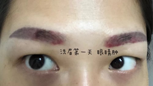 中国提拉脸部手术2023费用明细全新上线(2023中国提拉脸部手术参考价为：6189元)