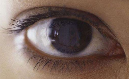 新疆镭射去黑眼圈治疗价位表剖析(2023新疆镭射去黑眼圈参考价为：6432元)