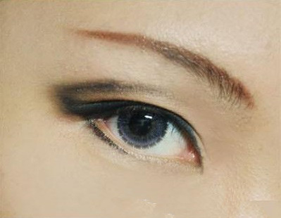 江苏埋线双眼皮开眼角治疗价格剖析(2023江苏埋线双眼皮开眼角参考价：4143-5822元)