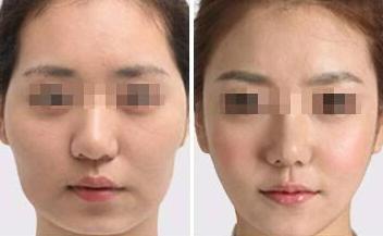 重庆当代整形美容医院：张国辉的彩光嫩肤技术效果如何？