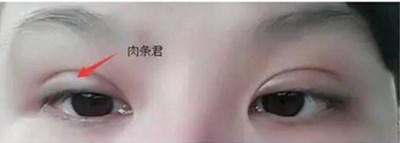 上海九院的顾斌医生：双眼皮风格考究、技术过硬，案例分享值得期待