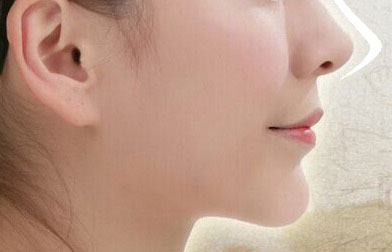 重庆整形医生：揭秘当代王旭明的鼻部整形案例及独特风格！