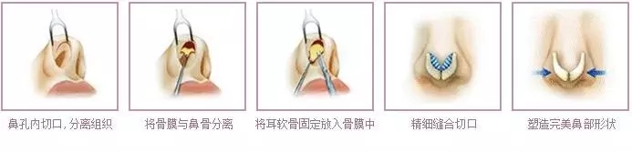 长沙三和整形医院：专家胡珍瑜帮您彻底摆脱烦恼的皮肤疣！
