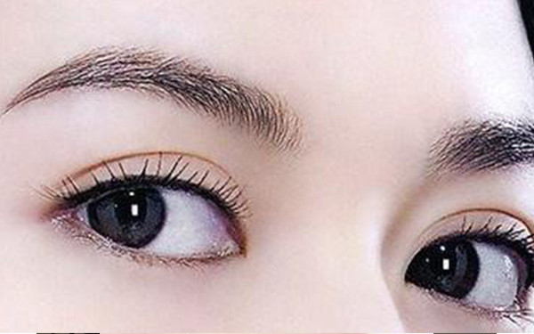 冯晓玲医生在武汉协和医院进行双眼皮手术的效果如何？受欢迎的医师案例分享，必看！