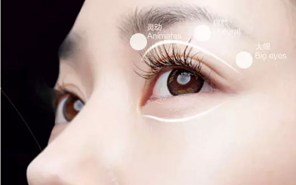 济南邱晓东双眼皮手术效果分享，一双眼睛重塑容颜